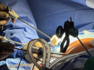 Minimalinvasive Operation