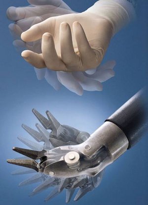 Vergleich zwischen Hand des Operateurs und einem Instrument (stark vergrößert) des da Vinci-Operationssystems.