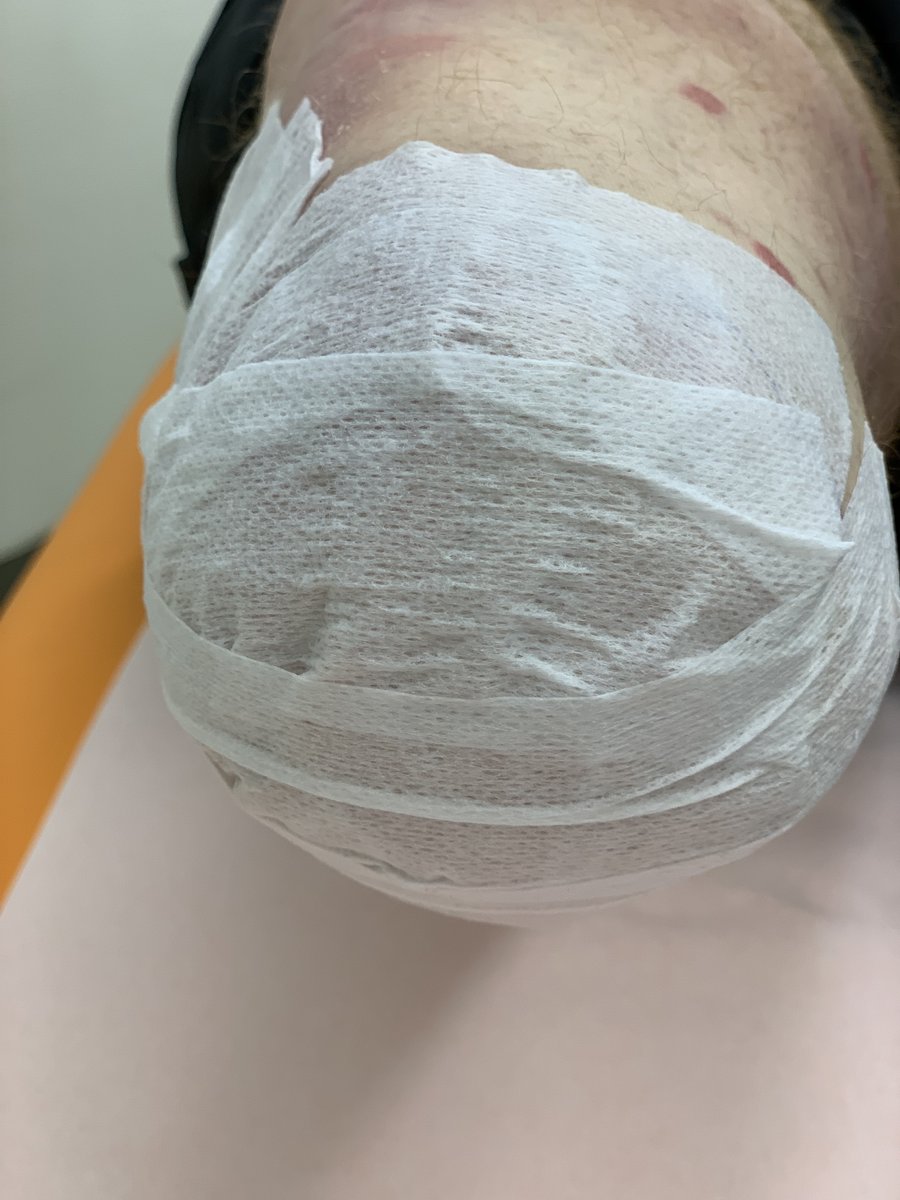 Capsaicin Pflaster Schmerzmedizin Klinikum Dortmund Größtes