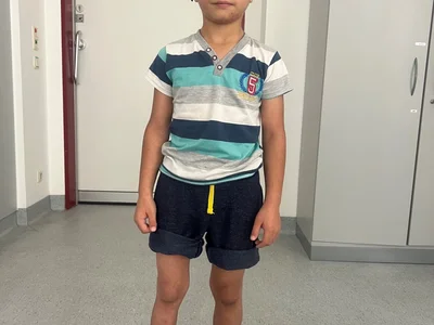 Mohammad (8) kann dank aufwendiger OP in der Kinderorthopädie wieder laufen