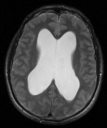 Bild zeigt 1. Röntgenaufnahme des Schädels / Gehirns