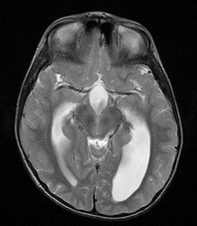 Bild zeigt 4. Röntgenaufnahme eines Schädels / Gehirns