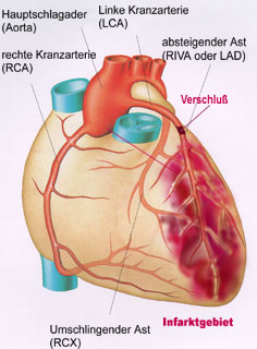 Aufbau latein herz Herzkranzgefäße (Koronarien)