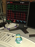Entscheidung welcher Stent