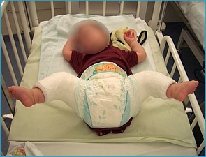 Bild zeigt Fettweishockgips
