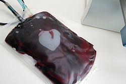 Großer Mangel: Blutspende-Zahlen brechen dramatisch ein