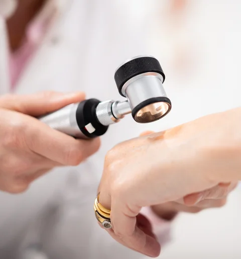 Hautuntersuchung mit dem Dermatoskop