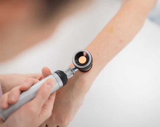 Hautuntersuchung mit dem Dermatoskop