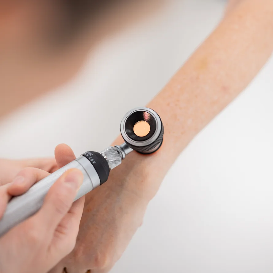 Hautuntersuchung mit dem Dermatoskop