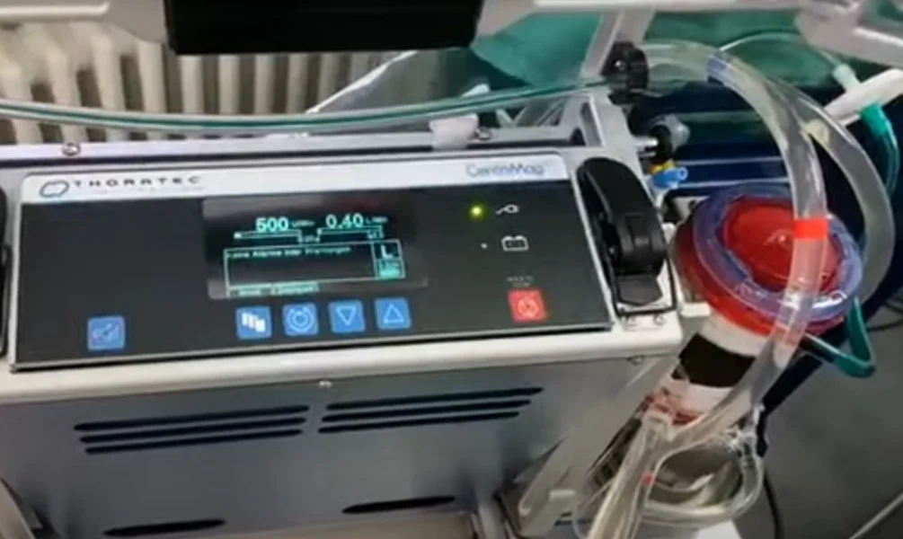 Mobile Ecmo für Herz-Lungen-Patientinnen und -patienten